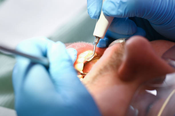 Best Weekend Emergency Dentist in Grass Valley, CA