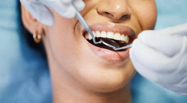 Best Emergency Root Canal Treatment in Grass Valley, CA