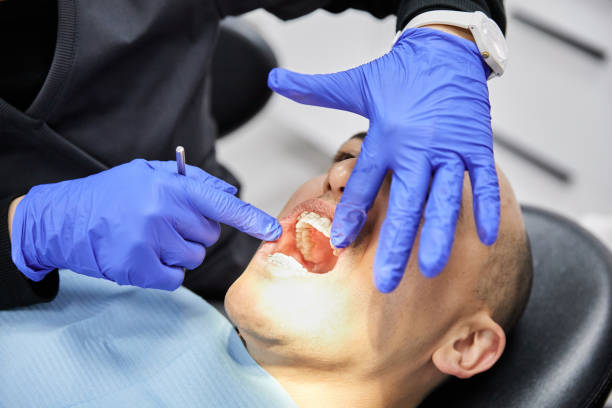 Best Emergency Dental Surgery in Grass Valley, CA